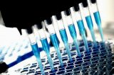 Esclusivo, Francia. Studio BNAA-Vacc, gli scienziati mostrano i rischi della “biopersistenza e neuromigrazione dell’alluminio dei vaccini”